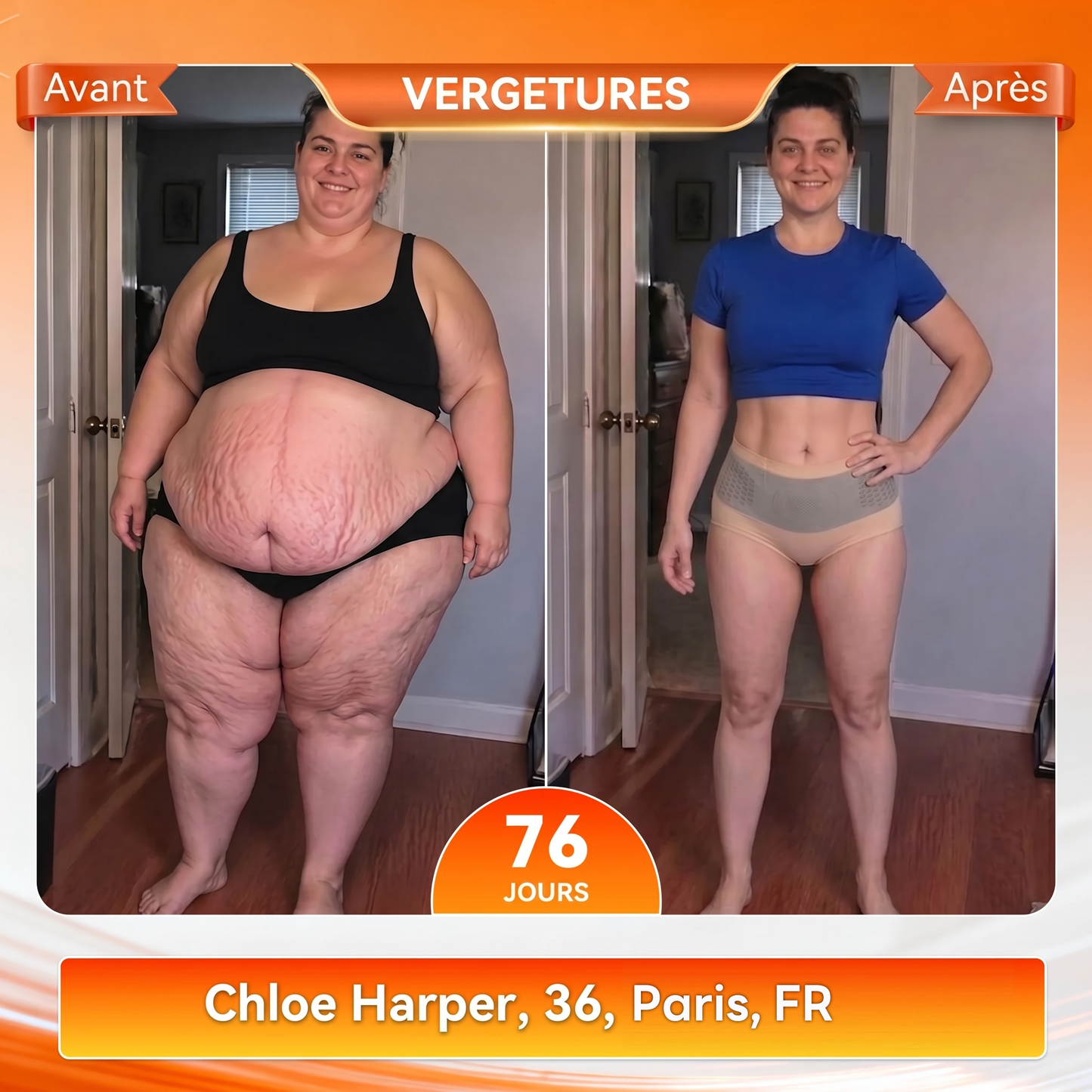 💕Best-sellers mondiaux✅Boutique Officielle de la Marque 💎 𝑪𝑼𝑺𝑰𝑱𝑨𝑺® 2026 Moringa & Berbérine 4-en-1 Micro-Particules Sculptantes & Brûlantes de Graisse Shorts