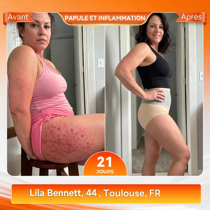 💕Best-sellers mondiaux✅Boutique Officielle de la Marque 💎 𝑪𝑼𝑺𝑰𝑱𝑨𝑺® 2026 Moringa & Berbérine 4-en-1 Micro-Particules Sculptantes & Brûlantes de Graisse Shorts